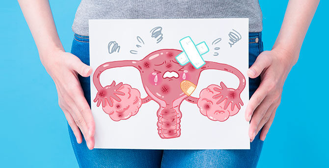 Cáncer de cérvix: qué es, formas de prevenirlo, cuidados y más